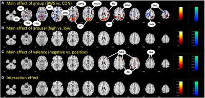 Comparison of Hemodynamic Brain Responses Between Big Wave Surfers and Non-big Wave Surfers During Affective Image Presentation